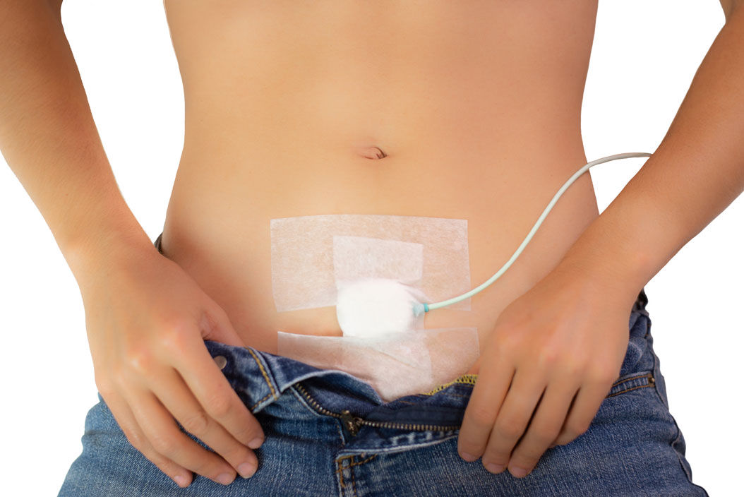 DFreeの装着イメージ